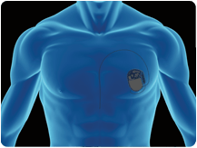 NI Medical Innovation Summit